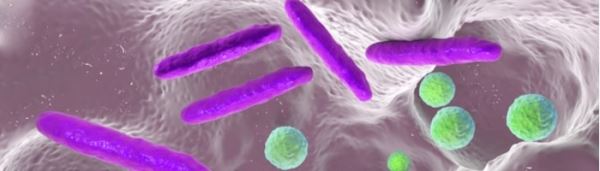 Ученые нашли бактериальную ДНК в эмболах, ставших причиной инсульта